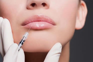 Lip Filler injections Sheffield | A For Aesthetics